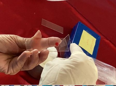 Confirma InDRE cinco casos de paludismo en la región del Istmo de Tehuantepec: SSO