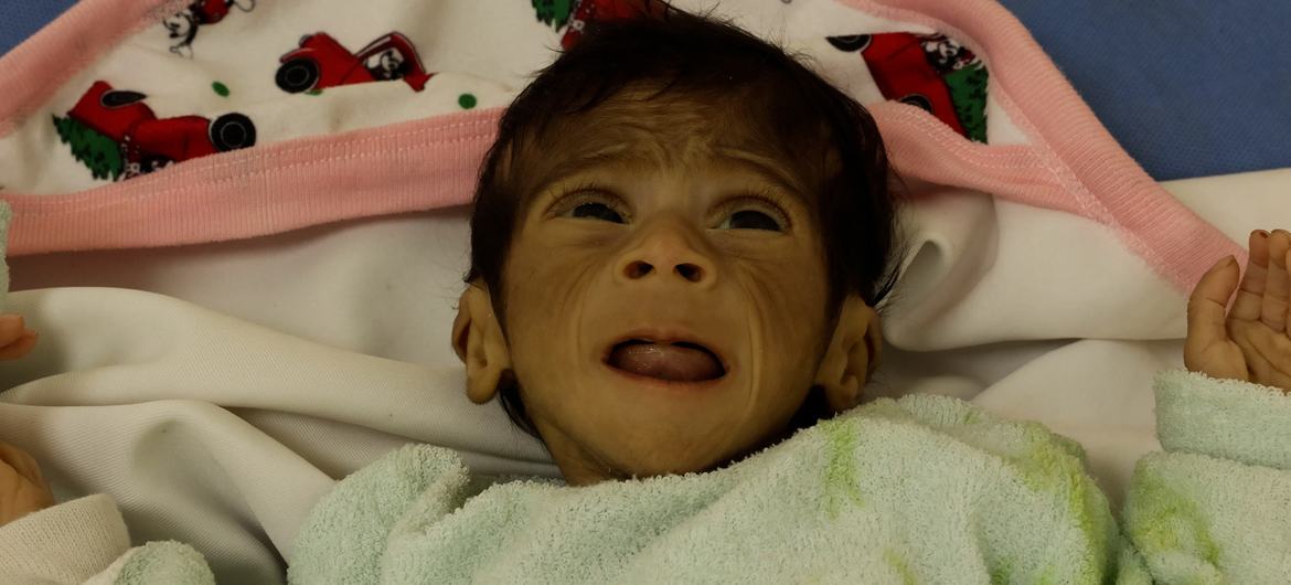 Alerta la Organización Mundial de la Salud de la ONU sobre una “hambruna masiva” en Gaza, provocada por el bloqueo de Israel