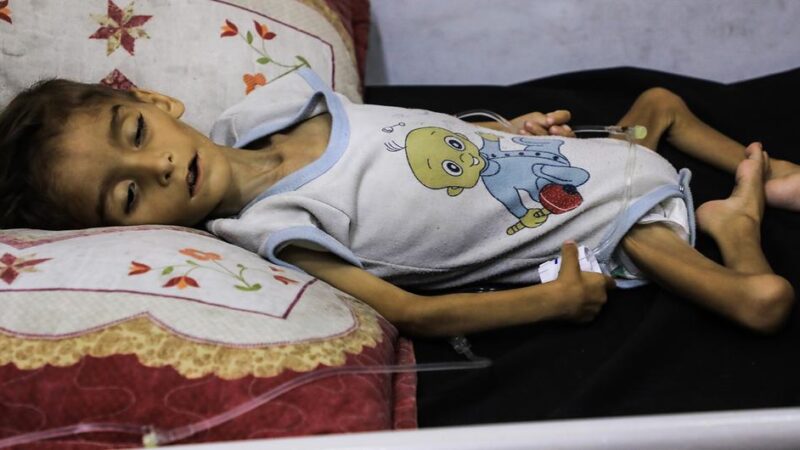 El hambre y la malnutrición siguen aumentando en Gaza por bloqueo del Ejército de Israel a la ayuda humanitaria