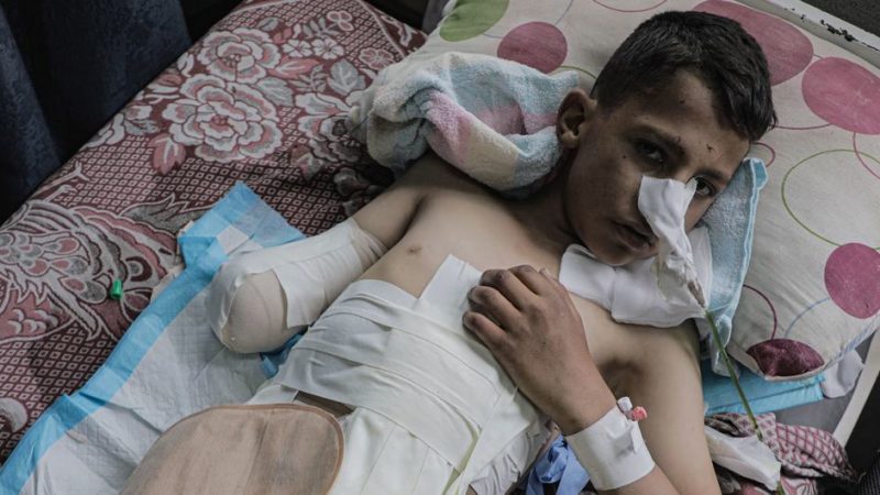 En Gaza más de 10.000 niños han sufrido lesiones con secuelas de por vida, por ataques militares de Israel