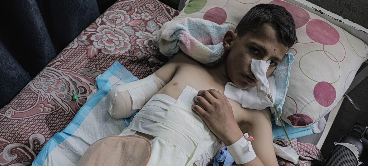 En Gaza más de 10.000 niños han sufrido lesiones con secuelas de por vida, por ataques militares de Israel